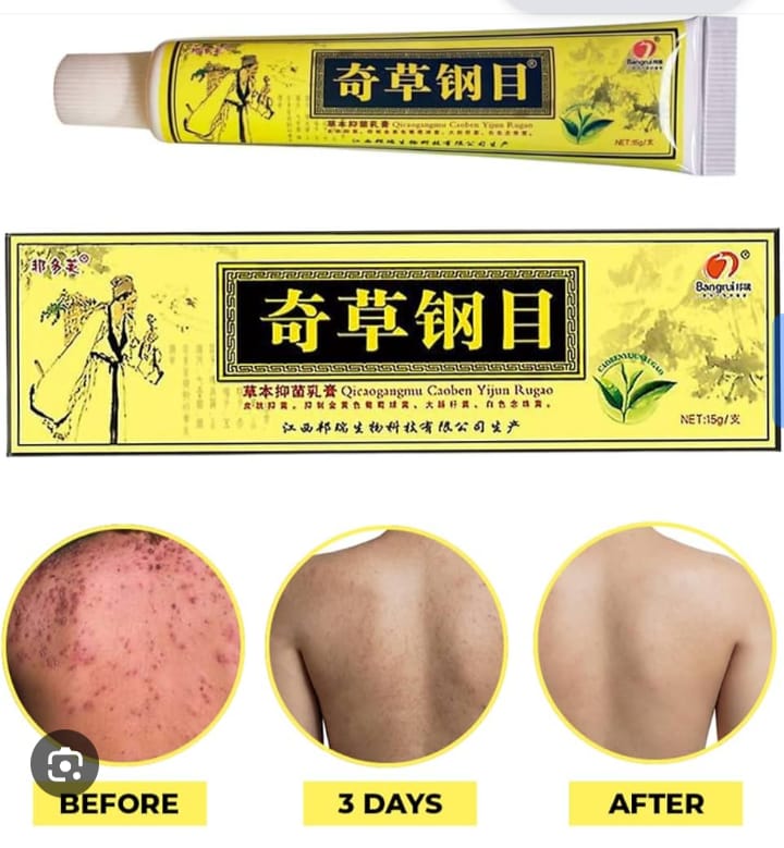 La solution simple pour dire stop aux imperfections
