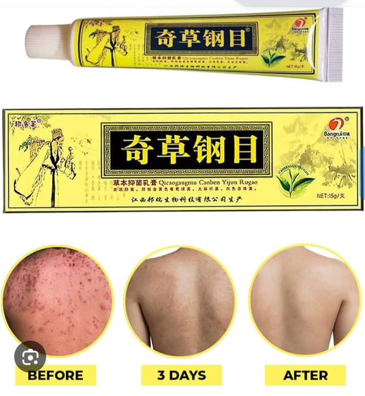 La solution simple pour dire stop aux imperfections