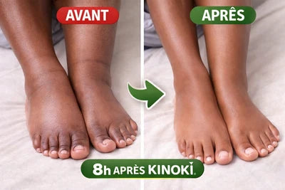 Patch Détox Naturel Pieds (KINOKI)